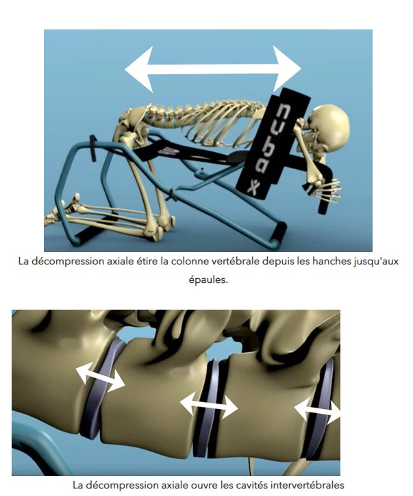 Nubax: Appareil d'étirement pour la colonne vertébrale - Bioloka